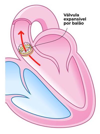 Cateterismo Cardiologista Dr. Gilberto Nunes | Porto Alegre item 2