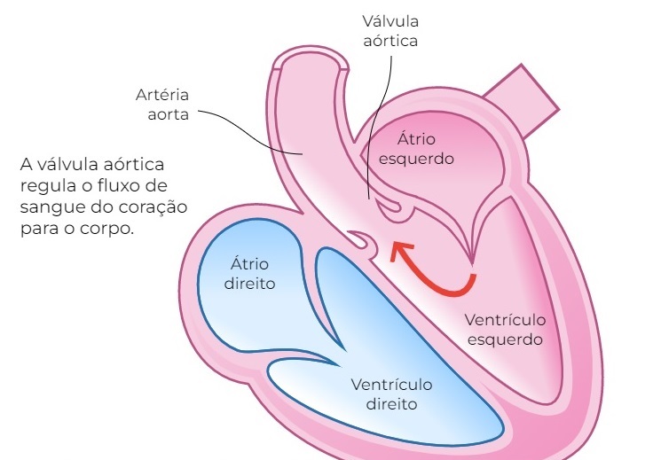 Doença Cardiovascular Cardiologista Dr. Gilberto Nunes | Porto Alegre valvula aortica