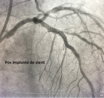 Cateterismo Cardiologista Dr. Gilberto Nunes | Porto Alegre 200522 materia santos cruz 2