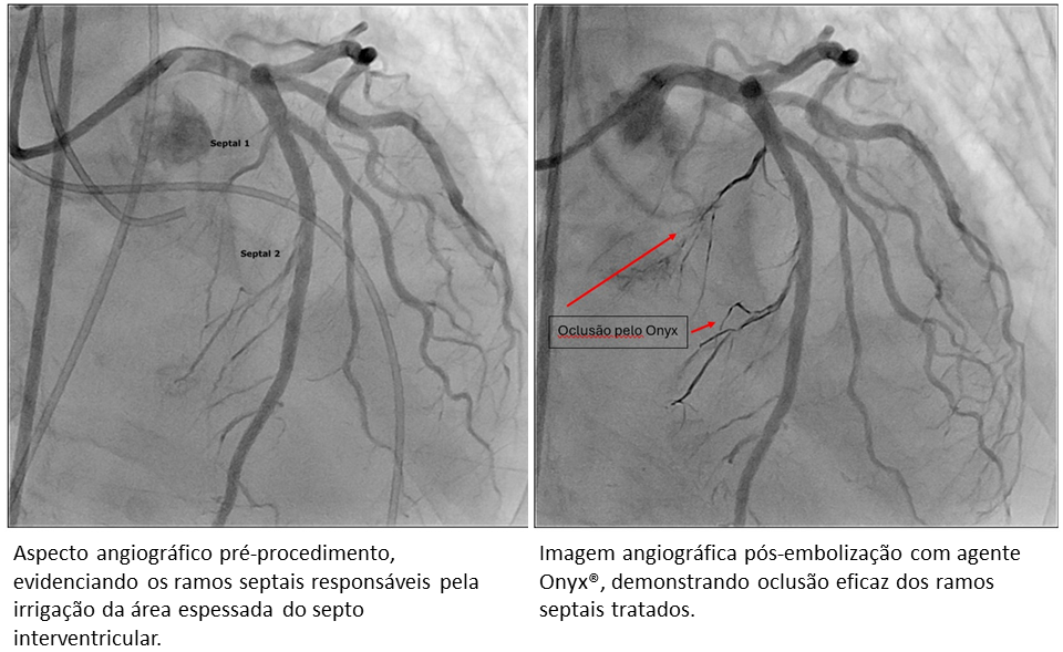 Notícias Cardiologista Dr. Gilberto Nunes | Porto Alegre Slide2